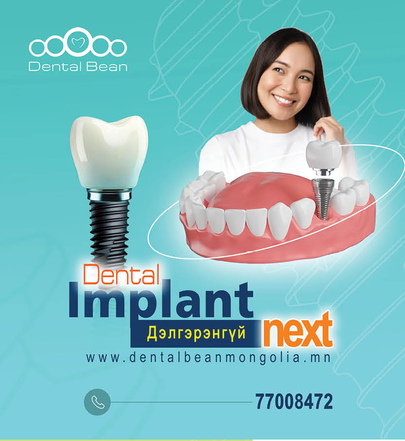 Dental Implant Next