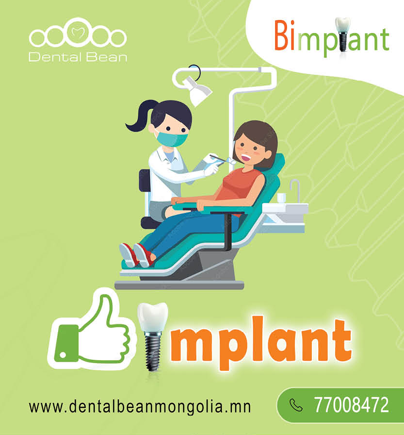 Bimplant Doctor