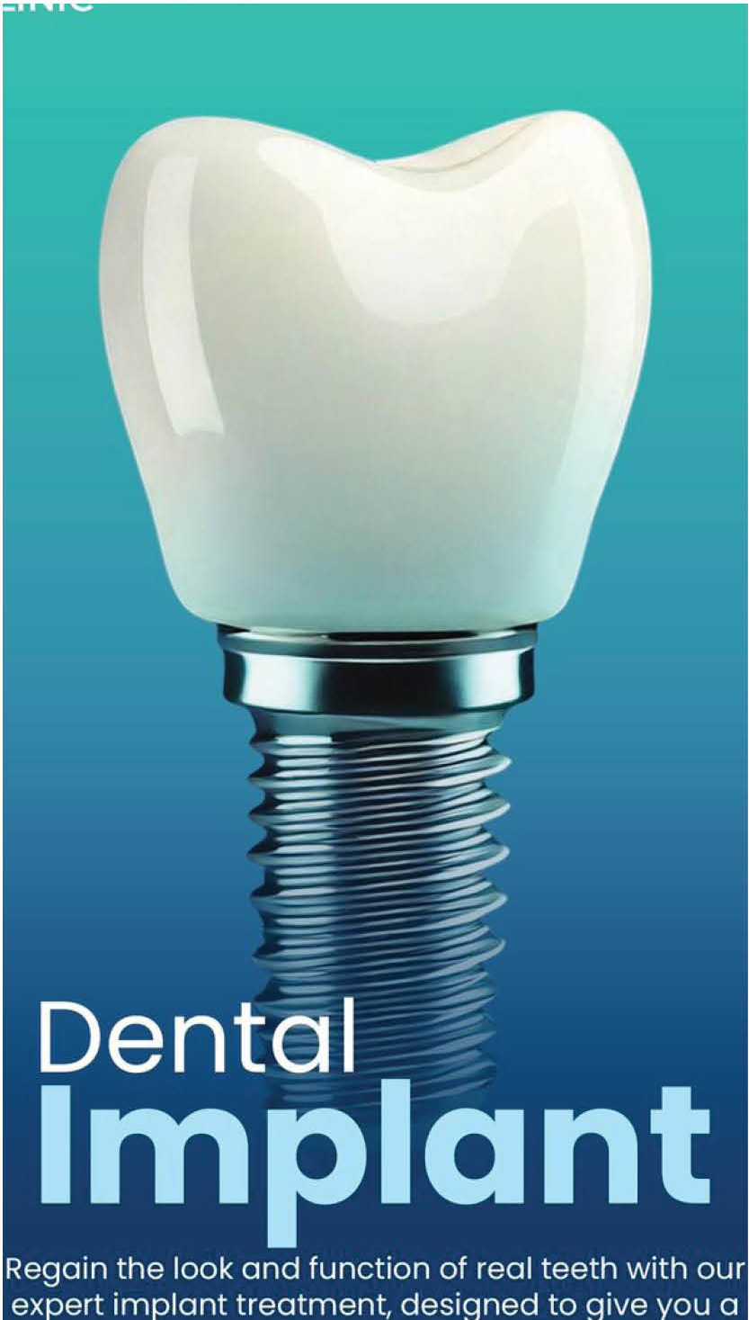 Dental Implant