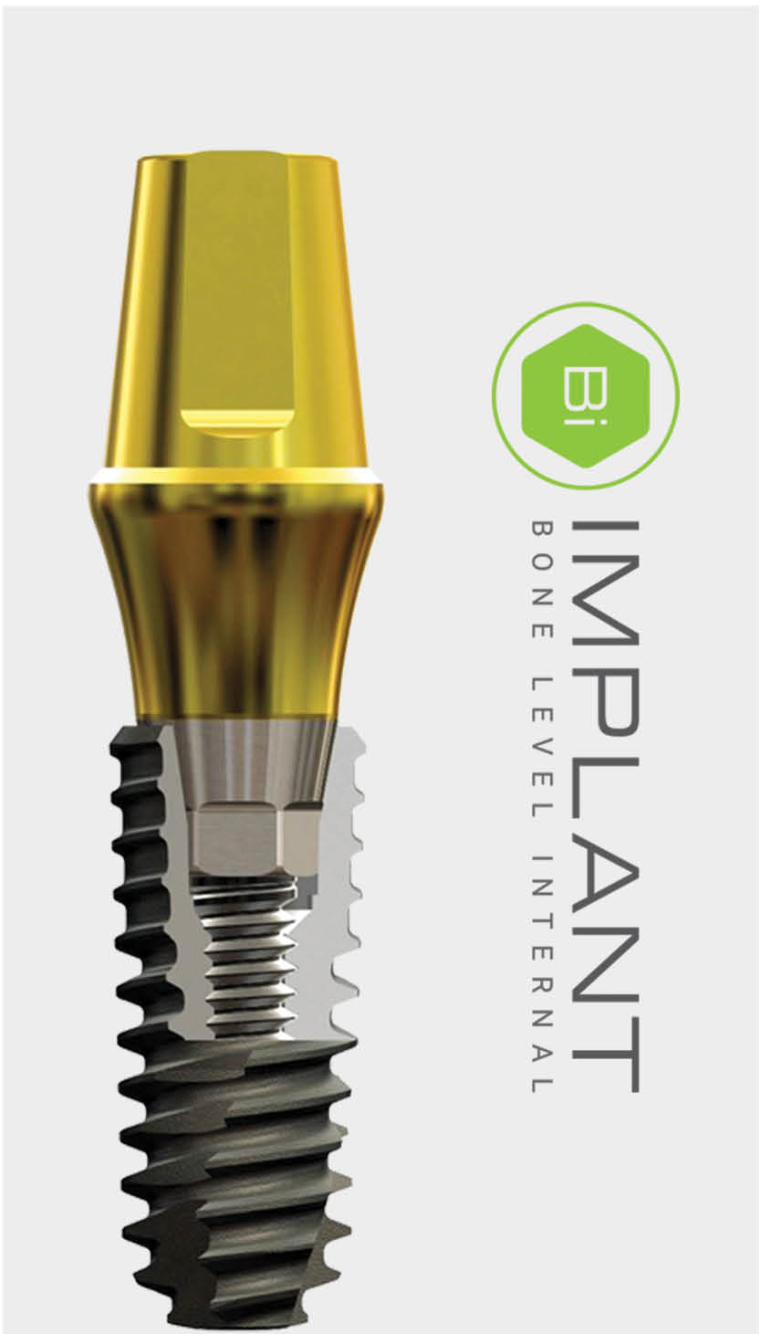 Bi Implant Gold